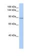 HK II antibody, orb330743, Biorbyt, Western Blot image 