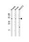 Mixed Lineage Kinase Domain Like Pseudokinase antibody, MBS9206965, MyBioSource, Western Blot image 