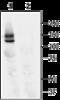 HERG antibody, GTX54785, GeneTex, Western Blot image 