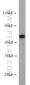 ADRB2 antibody, 13096-1-AP, Proteintech Group, Western Blot image 