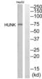 Hormonally Up-Regulated Neu-Associated Kinase antibody, abx015161, Abbexa, Western Blot image 