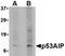 Tumor Protein P53 Regulated Apoptosis Inducing Protein 1 antibody, orb74447, Biorbyt, Western Blot image 