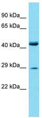 Paired Related Homeobox 2 antibody, TA332002, Origene, Western Blot image 