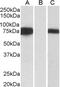 Forkhead Box C1 antibody, 45-603, ProSci, Western Blot image 