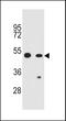 Caspase Recruitment Domain Family Member 16 antibody, LS-C166940, Lifespan Biosciences, Western Blot image 