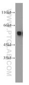 Protein Kinase, Membrane Associated Tyrosine/Threonine 1 antibody, 55098-1-AP, Proteintech Group, Western Blot image 