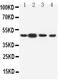 Dopamine Receptor D3 antibody, PA5-79170, Invitrogen Antibodies, Western Blot image 