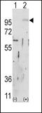 Fibroblast growth factor receptor 2 antibody, LS-C97522, Lifespan Biosciences, Western Blot image 