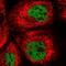 UBX Domain Protein 7 antibody, NBP2-47588, Novus Biologicals, Immunocytochemistry image 