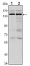 Lysine Demethylase 3A antibody, AM06548SU-N, Origene, Western Blot image 