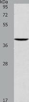 N(4)-(beta-N-acetylglucosaminyl)-L-asparaginase antibody, TA323762, Origene, Western Blot image 