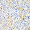 Adenosine Deaminase Domain Containing 1 antibody, 22-264, ProSci, Immunohistochemistry frozen image 