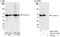 Coronin 1B antibody, A301-317A, Bethyl Labs, Immunoprecipitation image 