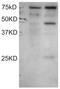 Dyslexia susceptibility 1 candidate gene 1 protein antibody, PA5-18347, Invitrogen Antibodies, Western Blot image 