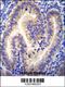 Coiled-Coil Domain Containing 54 antibody, 55-867, ProSci, Immunohistochemistry paraffin image 