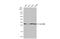 ANT2 antibody, GTX110983, GeneTex, Western Blot image 