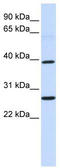 Wnt Family Member 16 antibody, TA344073, Origene, Western Blot image 