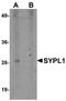 Synaptophysin Like 1 antibody, NBP1-76316, Novus Biologicals, Western Blot image 