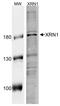 5'-3' Exoribonuclease 1 antibody, A02855, Boster Biological Technology, Western Blot image 