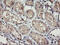 Receptor activity-modifying protein 2 antibody, M04768, Boster Biological Technology, Immunohistochemistry paraffin image 
