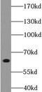 Ankyrin Repeat And LEM Domain Containing 1 antibody, FNab00402, FineTest, Western Blot image 