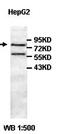 HHIP Like 2 antibody, orb77721, Biorbyt, Western Blot image 