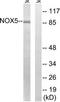 NADPH oxidase 5 antibody, TA315785, Origene, Western Blot image 
