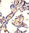 CAD protein antibody, A00463-3, Boster Biological Technology, Immunohistochemistry paraffin image 