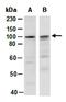 Dachshund Family Transcription Factor 1 antibody, orb67117, Biorbyt, Western Blot image 