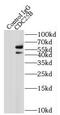 M-phase inducer phosphatase 2 antibody, FNab01522, FineTest, Immunoprecipitation image 