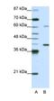 Zinc Finger Protein 843 antibody, orb324830, Biorbyt, Western Blot image 