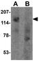 Small G Protein Signaling Modulator 1 antibody, GTX32093, GeneTex, Western Blot image 