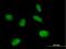 MIS12 Kinetochore Complex Component antibody, H00079003-B02P, Novus Biologicals, Immunofluorescence image 