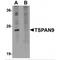 Tetraspanin 9 antibody, MBS150137, MyBioSource, Western Blot image 