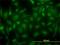 Creatine Kinase B antibody, H00001152-M01, Novus Biologicals, Immunocytochemistry image 