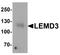 LEM Domain Containing 3 antibody, A04957, Boster Biological Technology, Western Blot image 