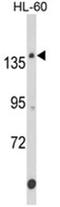 Fibronectin Type III Domain Containing 3B antibody, AP18023PU-N, Origene, Western Blot image 