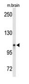 Lon Peptidase 2, Peroxisomal antibody, AP52512PU-N, Origene, Western Blot image 