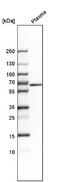 Mucin-13 antibody, NBP1-92147, Novus Biologicals, Western Blot image 