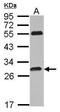 Phosphatidylinositol Transfer Protein Cytoplasmic 1 antibody, GTX115802, GeneTex, Western Blot image 
