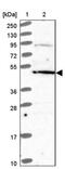 Diphthamide Biosynthesis 5 antibody, PA5-61242, Invitrogen Antibodies, Western Blot image 