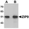 Solute Carrier Family 39 Member 9 antibody, LS-C144294, Lifespan Biosciences, Western Blot image 