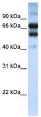 Retinoic Acid Receptor Gamma antibody, TA335181, Origene, Western Blot image 
