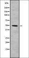 Putative alpha-1-antitrypsin-related protein antibody, orb337989, Biorbyt, Western Blot image 