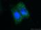 Zinc Finger Protein 184 antibody, 26100-1-AP, Proteintech Group, Immunofluorescence image 