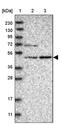 5'-Nucleotidase Domain Containing 1 antibody, PA5-56447, Invitrogen Antibodies, Western Blot image 