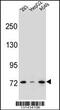 Zinc Finger Protein 569 antibody, 56-476, ProSci, Western Blot image 
