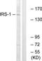 Insulin Receptor Substrate 1 antibody, TA312859, Origene, Western Blot image 