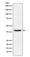 Ring Finger Protein 2 antibody, M01209, Boster Biological Technology, Western Blot image 