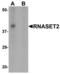 Ribonuclease T2 antibody, LS-B8807, Lifespan Biosciences, Western Blot image 